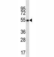 OKT4 antibody western blot of CD4 in CEM lysate