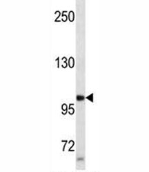 Progesterone Receptor antibody western blot analysis in SK-BR-3 lysate. Expected molecular weight: 82-94 kDa (isoform A) and 99-120 kDa (isoform B).