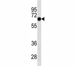 SOX9 antibody western blot analysis in K562 lysate. Predicted molecular weight: 56-65 kDa.