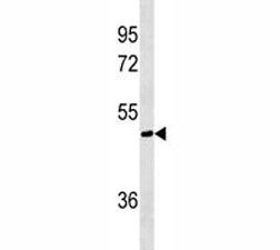 AKT1S1 antibody western blot analysis in A375 lysate. Expected molecular weight ~40 kDa.