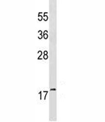 GABARAP antibody western blot analysis in mouse brain tissue lysate. Predicted molecular weight ~ 14 kDa.