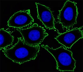 Immunofluorescent analysis of U251 cells using KIT antibody. Ab was diluted at 1:100 dilution. Dylight Fluor 488-conjugated goat anti-mouse lgG was used as the secondary Ab (green). Cytoplasmic actin was counterstained with Dylight Fluor 554 (red) conjugated Phalloidin (red).