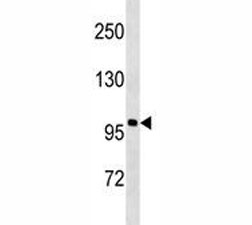 Anti-Androgen Receptor antibody western blot analysis in NCI-H292 lysate. Predicted molecular weight ~99kDa.