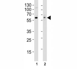 Western blot analysis of lysate from (1) HT29 and (2) Jurkat cell line using anti-Src antibody at 1:1000.