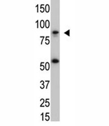 The IKK beta antibody used in western blot with SK-BR3 cell lysate. Predicted molecular weight ~87 kDa.