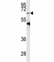 Western blot analysis of PRMT5 antibody and HL-60 lysate