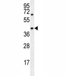 AMACR antibody western blot analysis in MDA-MB-231 lysate. Predicted molecular weight ~43 kDa.