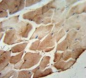 ACOT11 antibody immunohistochemistry analysis in formalin fixed and paraffin embedded human skeletal muscle.