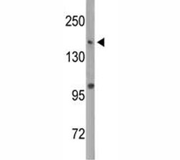 Western blot analysis of Dnmt1 antibody and MDA-MB435 lysate. Predicted molecular weight: 180-200 kDa
