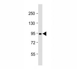 Western blot testing of Dnmt3b antibody at 1:2000 dilution + T47D lysate; Predicted molecular weight: 95 kDa.