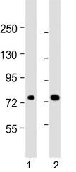 ABCD1 antibody western blot analysis in human 1) 293/T17 and 2) HL-60 lysate. Predicted molecular weight ~83 kDa.