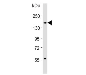 Western blot testing of human spleen lysate with CD11b antibody. Expected molecular weight: 128-170 kDa depending on glycosylation level.