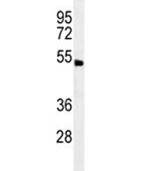 ABHD8 antibody western blot analysis in human NCI-H292 lysate. Predicted molecular weight ~47 kDa.