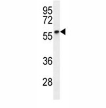 Cyclin B1 antibody western blot analysis in MDA-MB231 lysate. Predicted molecular weight: 48-60 kDa
