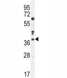 Caspase-3 antibody western blot analysis in MDA-MB435 lysate