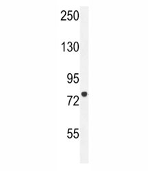 CPT1C antibody western blot analysis in HL-60 lysate. Predicted molecular weight 81-91 kDa.