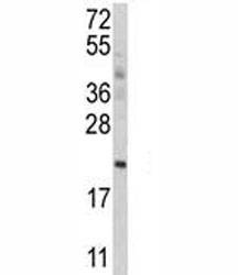 Western blot analysis of ATG12 antibody and MCF-7 lysate.
