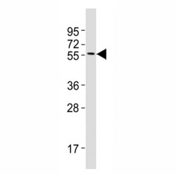 Western blot testing of MITF antibody at 1:2000 dilution + A375 lysate; Predicted molecular weight: 55-60 kDa.