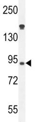 Myeloperoxidase antibody western blot analysis in HL-60 lysate.  Expected molecular weight: 59-64 kDa (alpha chain, may be observed at higher molecular weights due to glycosylation), 150+ kDa (glycosylated mature form).