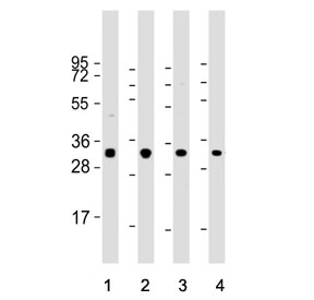 Western blot testing of human 1) HeLa, 2) HL60, 3) Jurkat and 4) MOLT4 cell lysate with Osteopontin antibody. Predicted molecular weight: 35-65 kDa depending on degree of glycosylation.
