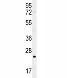 H-RAS antibody western blot analysis in mouse cerebellum tissue lysate. Predicted molecular weight ~ 21 kDa.