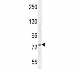 Nucleolin antibody western blot analysis in HepG2 lysate. Predicted molecular weight is 77 kDa, observed size is 100~110 kDa.