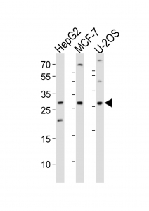 Western blot analysis of lysate from HepG2, MCF-7, U-2OS cell line (left to right) using ID1 antibody; Ab was diluted at 1:1000 for each lane.