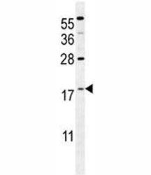 S100A4 antibody western blot analysis in mouse NIH3T3 lysate. Predicted molecular weight ~12 kDa.
