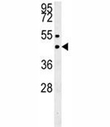 SUV39H1 western blot analysis in MDA-MB435 lysate.