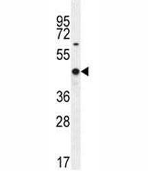 WT1 antibody western blot analysis in MCF-7 lysate. Predicted molecular weight: ~49 kDa