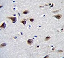 MeCP2 antibody immunohistochemistry analysis in formalin fixed and paraffin embedded human brain tissue.