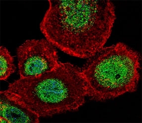 Fluorescent confocal image of A431 cell stained with LEF1 antibody at 1:25. LEF1 immunoreactivity is localized to the nucleus strongly and cytoplasm weakly.