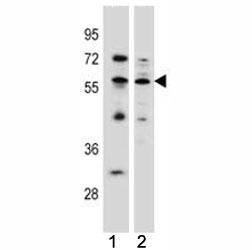 KLF4 antibody western blot analysis in (1) MCF-7 (2) K562 lysate. Predicted molecular weight: 50-60 kDa + possible ~75 kDa (phosphorylated form).