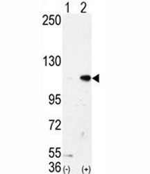 Western blot analysis of LSD1 antibody and 293 cell lysate either nontransfected (Lane 1) or transiently transfected with the AOF2/LSD1 gene (2). Expected molecular weight ~110kDa.