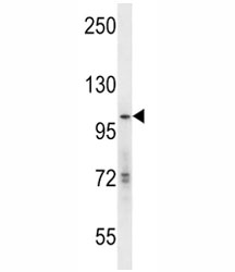 GCN5 antibody western blot analysis in mouse Neuro-2a lysate. Expected molecular weight ~94 kDa.