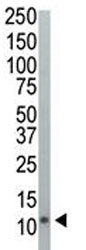 Western blot analysis of Ubiquitin antibody and HeLa cell lysate