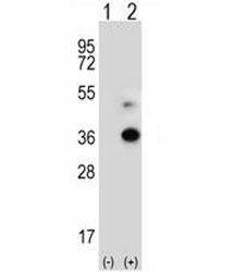 Western blot analysis of ANGPTL7 antibody and 293 cell lysate either nontransfected (Lane 1) or transiently transfected (2) with the ANGPTL7 gene. Predicted molecular weight ~35 kDa, observed at 35-50 kDa depending on glycosylation level.
