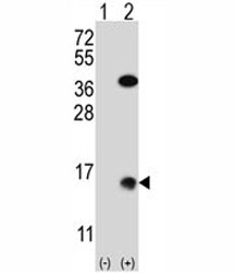 Western blot analysis of SUMO2 antibody and 293 cell lysate (2 ug/lane) either nontransfected (Lane 1) or transiently transfected (2) with the SUMO2 gene.
