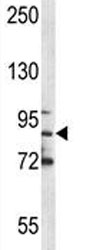 MPO antibody western blot analysis in NCI-H460 lysate. Expected molecular weight: 59-64 kDa (alpha chain, may be observed at higher molecular weights due to glycosylation), 150+ kDa (glycosylated mature form).