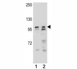 AR antibody western blot analysis in (1) NCI-H292, and (1) NCI-H460 lysate. Predicted molecular weight ~99kDa.