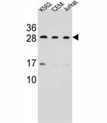 CD79a antibody western blot analysis in K562, CEM, Jurkat lysate. Predicted/Observed molecular weight: 25~47 kDa depending on glycosylation level