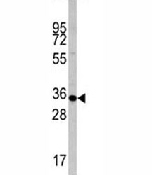 Western blot analysis of Caspase-6 antibody and mouse liver tissue lysate. Predicted molecular weight: ~33 kDa (precursor).