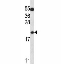 BAX antibody western blot analysis in K562 lysate
