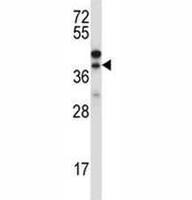 Western blot testing of CTGF antibody and NCI-H460 lysate. Predicted/observed molecular weight ~38kDa.