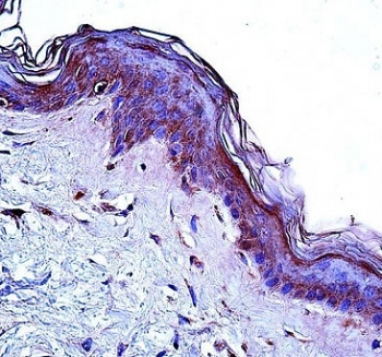 CD1a antibody immunohistochemistry analysis in formalin fixed and paraffin embedded human skin tissue.