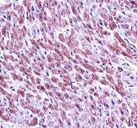 SMAD3 antibody immunohsitochemistry analysis in formalin fixed and paraffin embedded human heart tissue.