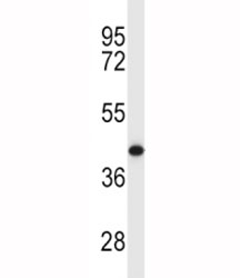 MCL1 antibody western blot analysis in Y79 lysate. Predicted molecular weight: 37/29 kDa (isoforms 1/2).