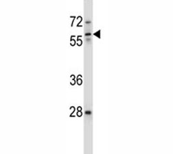ICAM3 antibody western blot analysis in ZR-75-1 lysate. Observed molecular weight: 60~120 kDa depending on glycosylation level.