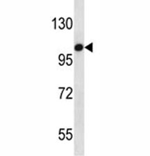 TLR7 antibody western blot analysis in HepG2 lysate