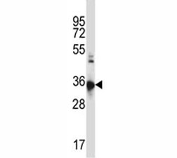 CCR10 antibody western blot analysis in HL-60 lysate. Predicted molecular weight ~38 kDa.